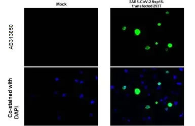 Immunohistochemistry (Formalin/PFA-fixed paraffin-embedded sections) - Anti-SARS-CoV-2 nsp15 antibody [HL1445] - BSA and Azide free (AB313850)