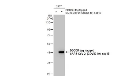 Western blot - Anti-SARS-CoV-2 nsp15 antibody [HL1445] - BSA and Azide free (AB313850), expandable thumbnail