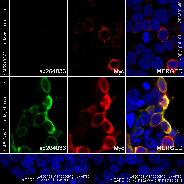 Immunocytochemistry/ Immunofluorescence - Anti-SARS-CoV-2 nsp2 antibody [EPR24853-4] - BSA and Azide free (AB284050)