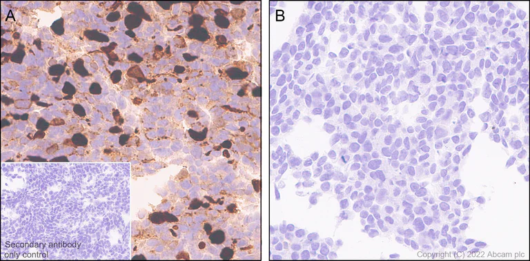Immunohistochemistry (Formalin/PFA-fixed paraffin-embedded sections) - Anti-SARS-CoV-2 nsp2 antibody [EPR24853-4] - BSA and Azide free (AB284050)