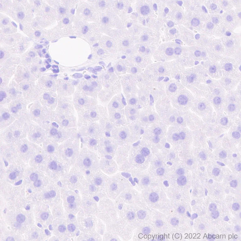 Immunohistochemistry (Formalin/PFA-fixed paraffin-embedded sections) - Anti-SARS-CoV-2 nsp2 antibody [EPR24853-4] - BSA and Azide free (AB284050)