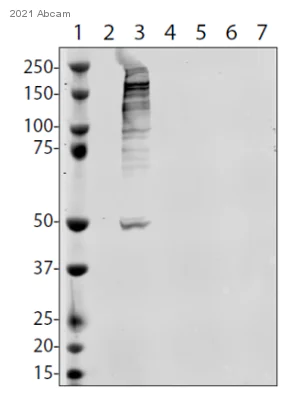 Western blot - Anti-SARS-COV-2 nsp3 antibody [EPR24842-84] (AB283958)