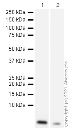 Western blot - Anti-SARS-CoV-2 nsp6 antibody [EPR24845-90] (AB284633), expandable thumbnail