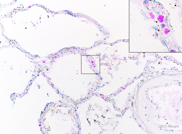 Immunohistochemistry (Formalin/PFA-fixed paraffin-embedded sections) - Anti-SARS-COV-2 nsp8 antibody [EPR24854-42] - BSA and Azide free (AB283955), expandable thumbnail
