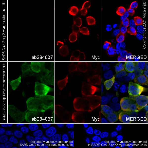 Immunocytochemistry/ Immunofluorescence - Anti-SARS-CoV-2 nsp9 antibody [EPR24855-25] - BSA and Azide free (AB284051)