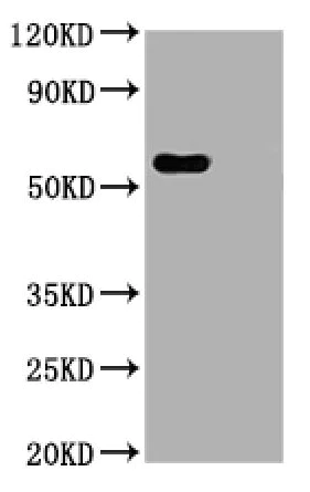 Western blot - Anti-SARS-CoV-2 nucleocapsid protein antibody [1A6] - Human IgG1 (Chimeric) (AB272852)