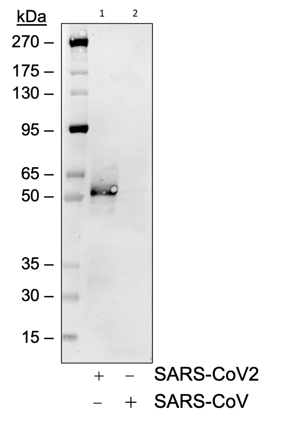 Western blot - Anti-SARS-CoV-2 nucleocapsid protein antibody [75G5a] (AB284653)