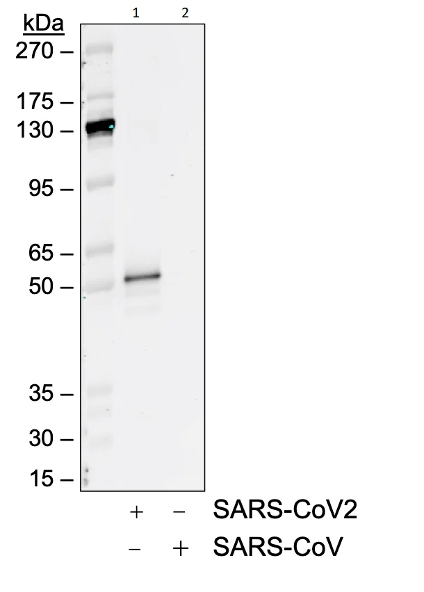 Western blot - Anti-SARS-CoV-2 nucleocapsid protein antibody [85C10] (AB284650)