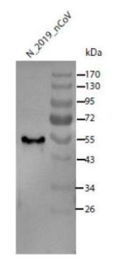 Western blot - Anti-SARS-CoV-2 nucleocapsid protein antibody (AB273167), expandable thumbnail