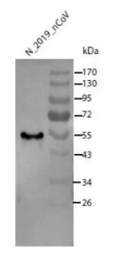 Western blot - Anti-SARS-CoV-2 nucleocapsid protein antibody (AB273167)