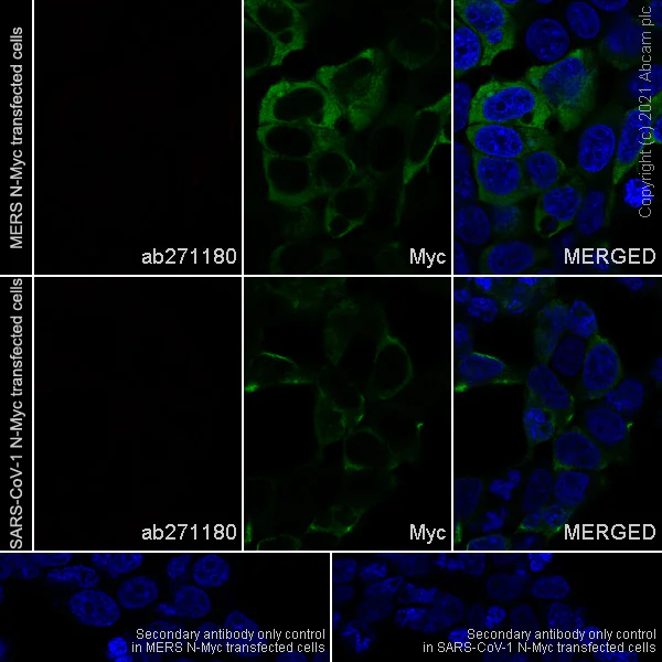 Immunocytochemistry/ Immunofluorescence - Anti-SARS-CoV-2 nucleocapsid protein antibody [EPR24334-118] - BSA and Azide free (AB280201)