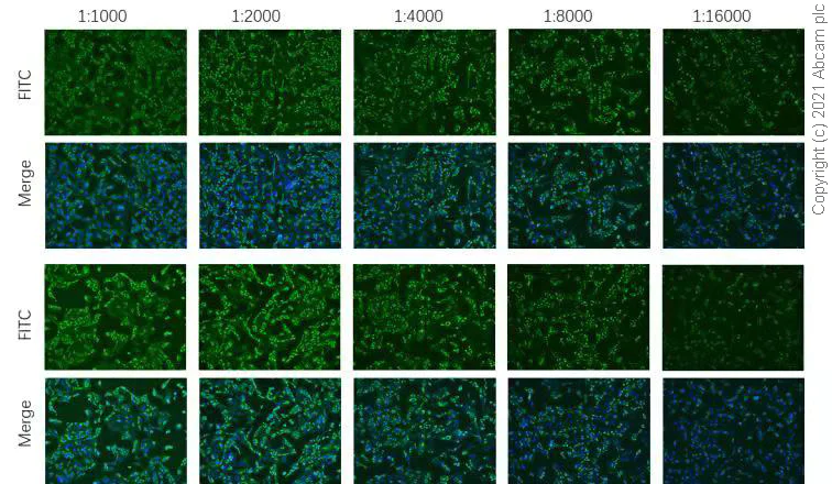 Immunocytochemistry/ Immunofluorescence - Anti-SARS-CoV-2 nucleocapsid protein antibody [EPR24334-118] - BSA and Azide free (AB280201)