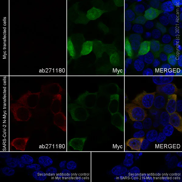 Immunocytochemistry/ Immunofluorescence - Anti-SARS-CoV-2 nucleocapsid protein antibody [EPR24334-118] - BSA and Azide free (AB280201)