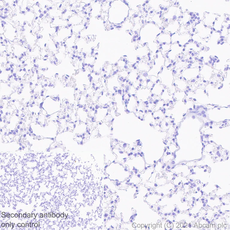 Immunohistochemistry (Formalin/PFA-fixed paraffin-embedded sections) - Anti-SARS-CoV-2 nucleocapsid protein antibody [EPR24334-118] - BSA and Azide free (AB280201)