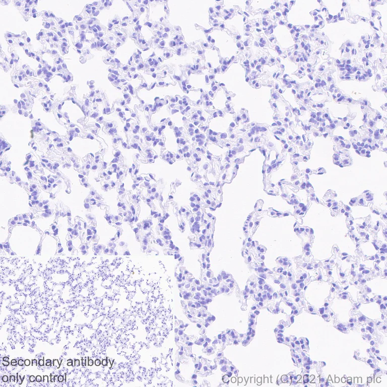 Immunohistochemistry (Formalin/PFA-fixed paraffin-embedded sections) - Anti-SARS-CoV-2 nucleocapsid protein antibody [EPR24334-118] - BSA and Azide free (AB280201)