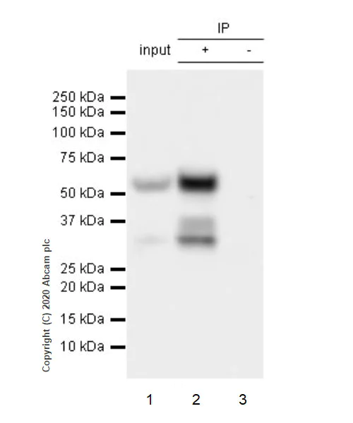 Immunoprecipitation - Anti-SARS-CoV-2 nucleocapsid protein antibody [EPR24334-118] - BSA and Azide free (AB280201)