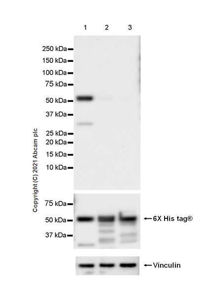 Western blot - Anti-SARS-CoV-2 nucleocapsid protein antibody [EPR24334-118] - BSA and Azide free (AB280201), expandable thumbnail