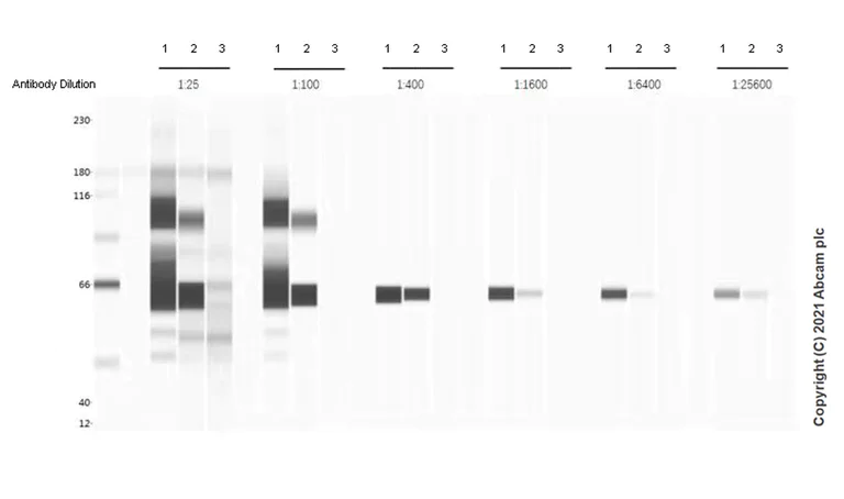 Western blot - Anti-SARS-CoV-2 nucleocapsid protein antibody [EPR24334-118] - BSA and Azide free (AB280201)
