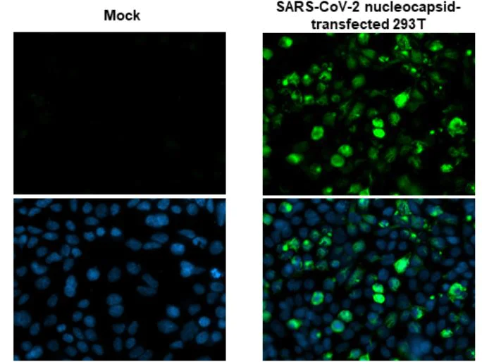 Immunocytochemistry - Anti-SARS-CoV-2 nucleocapsid protein antibody [HL146] - BSA and Azide free (AB281294)