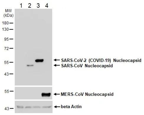 Western blot - Anti-SARS-CoV-2 nucleocapsid protein antibody [HL146] - BSA and Azide free (AB281294)