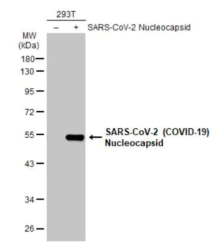 Western blot - Anti-SARS-CoV-2 nucleocapsid protein antibody [HL146] - BSA and Azide free (AB281294)