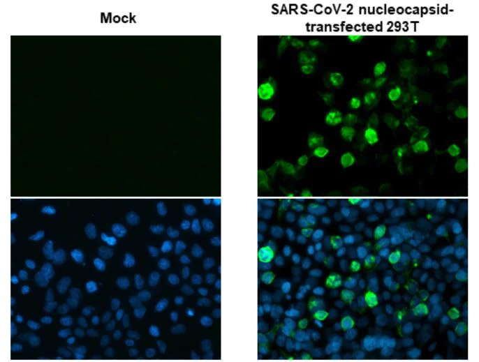 Immunocytochemistry - Anti-SARS-CoV-2 nucleocapsid protein antibody [HL249] - BSA and Azide free (AB281295)