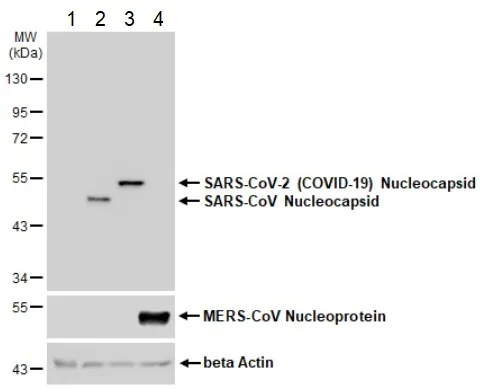 Western blot - Anti-SARS-CoV-2 nucleocapsid protein antibody [HL249] - BSA and Azide free (AB281295)