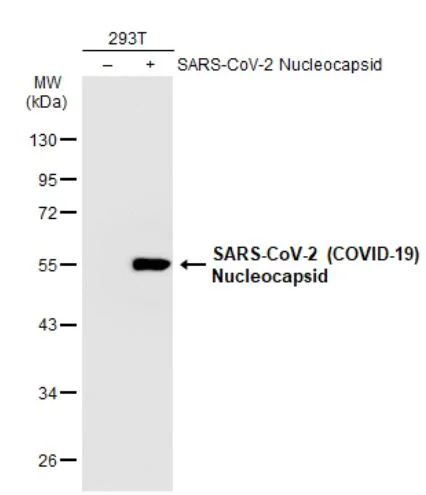 Western blot - Anti-SARS-CoV-2 nucleocapsid protein antibody [HL249] - BSA and Azide free (AB281295)