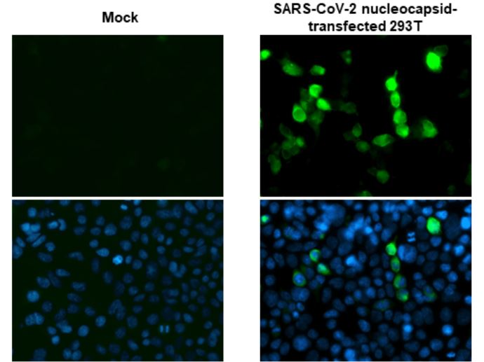 Immunocytochemistry - Anti-SARS-CoV-2 nucleocapsid protein antibody [HL344] - BSA and Azide free (AB281296), expandable thumbnail
