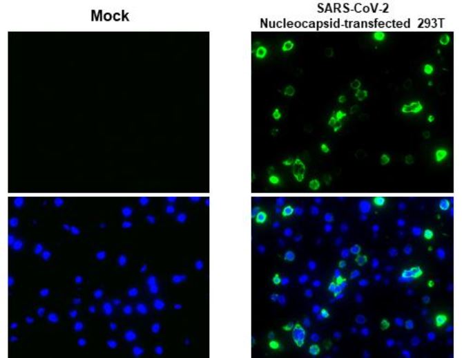 Immunohistochemistry (Formalin/PFA-fixed paraffin-embedded sections) - Anti-SARS-CoV-2 nucleocapsid protein antibody [HL344] - BSA and Azide free (ab281296), expandable thumbnail