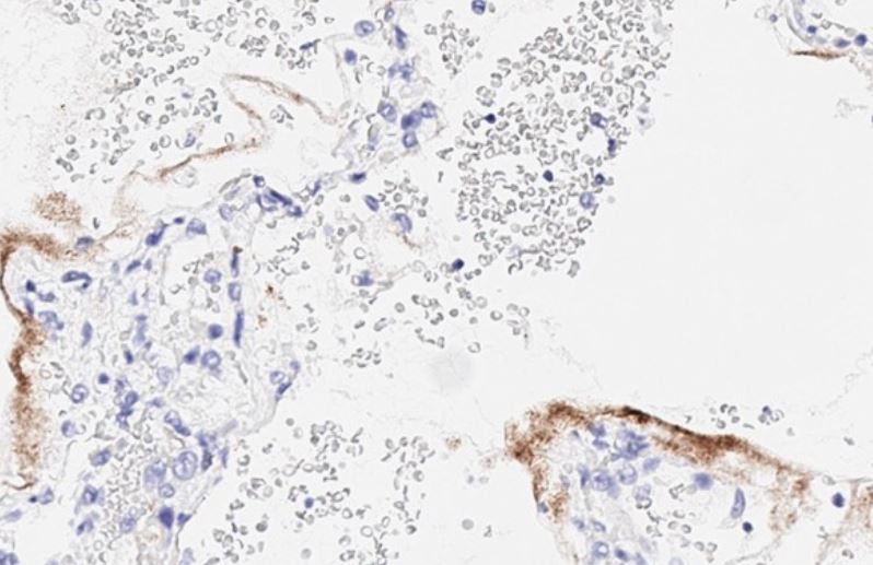 Immunohistochemistry (Formalin/PFA-fixed paraffin-embedded sections) - Anti-SARS-CoV-2 nucleocapsid protein antibody [HL344] - BSA and Azide free (AB281296), expandable thumbnail