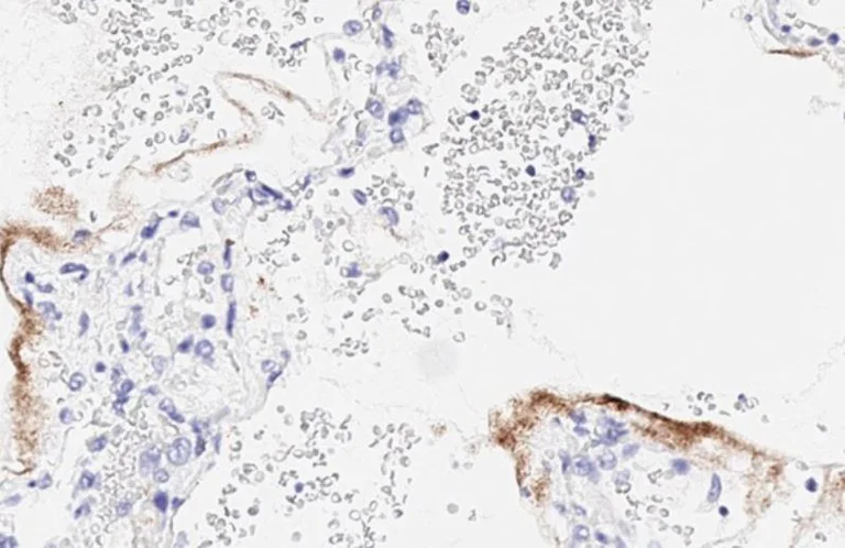 Immunohistochemistry (Formalin/PFA-fixed paraffin-embedded sections) - Anti-SARS-CoV-2 nucleocapsid protein antibody [HL344] - BSA and Azide free (AB281296)