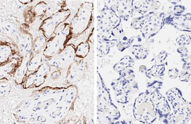 Immunohistochemistry (Formalin/PFA-fixed paraffin-embedded sections) - Anti-SARS-CoV-2 nucleocapsid protein antibody [HL344] - BSA and Azide free (AB281296), expandable thumbnail