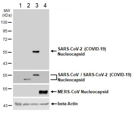Western blot - Anti-SARS-CoV-2 nucleocapsid protein antibody [HL344] - BSA and Azide free (AB281296), expandable thumbnail