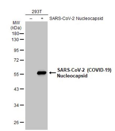 Western blot - Anti-SARS-CoV-2 nucleocapsid protein antibody [HL344] - BSA and Azide free (ab281296), expandable thumbnail