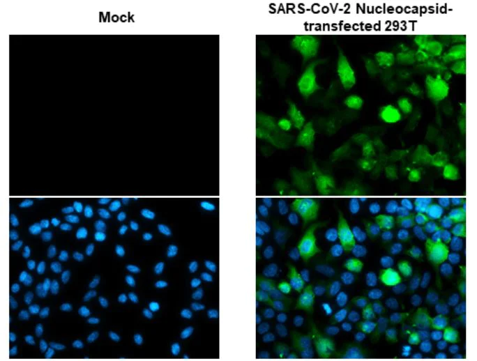 Immunocytochemistry - Anti-SARS-CoV-2 nucleocapsid protein antibody [HL448] - BSA and Azide free (AB281297)
