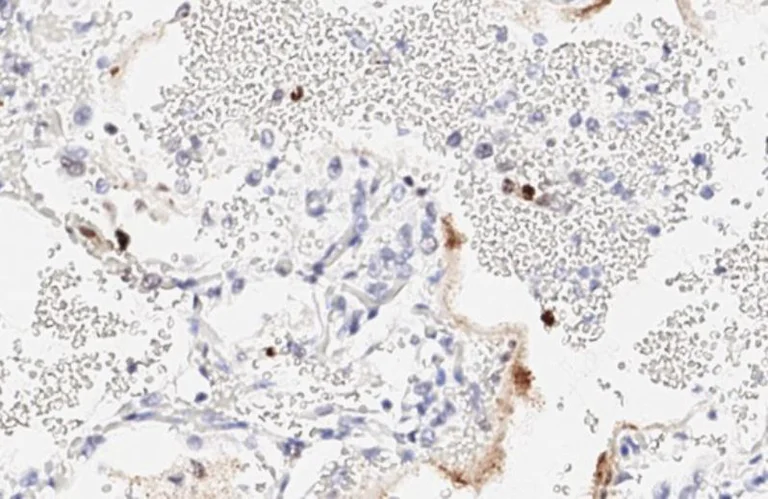 Immunohistochemistry (Formalin/PFA-fixed paraffin-embedded sections) - Anti-SARS-CoV-2 nucleocapsid protein antibody [HL448] - BSA and Azide free (AB281297)