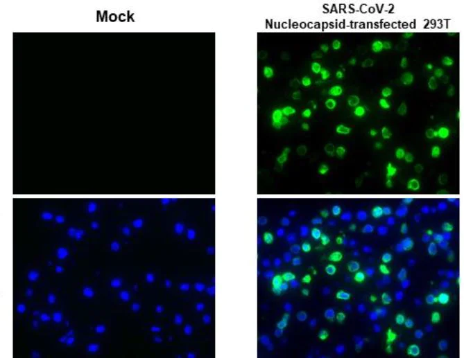 Immunohistochemistry (Formalin/PFA-fixed paraffin-embedded sections) - Anti-SARS-CoV-2 nucleocapsid protein antibody [HL448] - BSA and Azide free (AB281297)