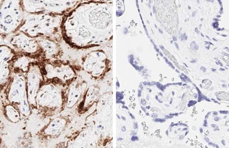 Immunohistochemistry (Formalin/PFA-fixed paraffin-embedded sections) - Anti-SARS-CoV-2 nucleocapsid protein antibody [HL448] - BSA and Azide free (AB281297)