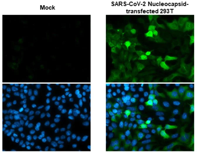 Immunocytochemistry - Anti-SARS-CoV-2 nucleocapsid protein antibody [HL453] - BSA and Azide free (AB281298)