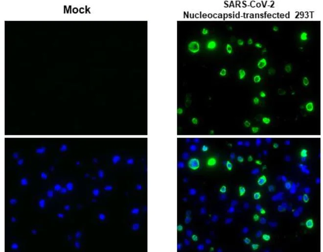 Immunohistochemistry (Formalin/PFA-fixed paraffin-embedded sections) - Anti-SARS-CoV-2 nucleocapsid protein antibody [HL453] - BSA and Azide free (AB281298)