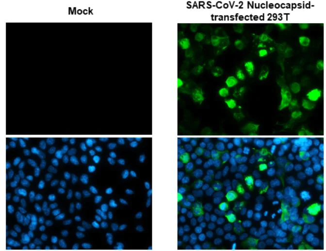 Immunocytochemistry - Anti-SARS-CoV-2 nucleocapsid protein antibody [HL455] - BSA and Azide free (AB281299)