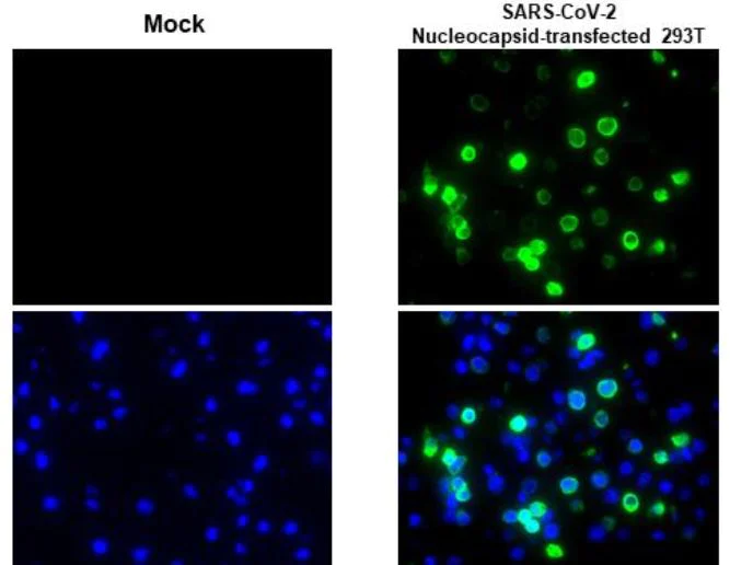 Immunohistochemistry (Formalin/PFA-fixed paraffin-embedded sections) - Anti-SARS-CoV-2 nucleocapsid protein antibody [HL455] - BSA and Azide free (AB281299)