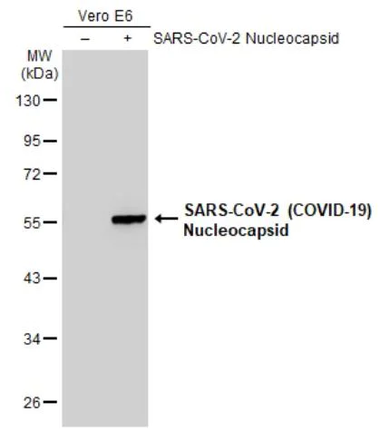 Western blot - Anti-SARS-CoV-2 nucleocapsid protein antibody [HL455] - BSA and Azide free (AB281299)