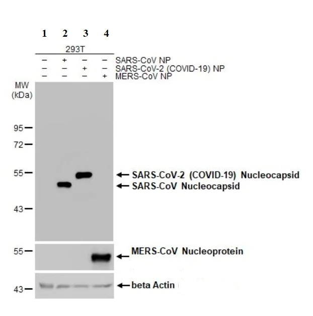 Western blot - Anti-SARS-CoV-2 nucleocapsid protein antibody [HL455] - BSA and Azide free (AB281299)
