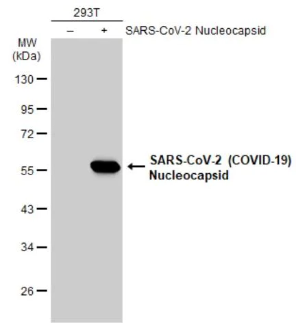 Western blot - Anti-SARS-CoV-2 nucleocapsid protein antibody [HL455] - BSA and Azide free (AB281299)