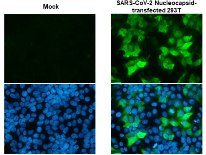 Immunocytochemistry - Anti-SARS-CoV-2 nucleocapsid protein antibody [HL455-MS] - BSA and Azide free (AB281300), expandable thumbnail