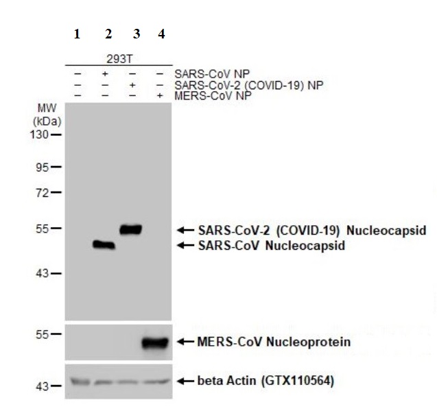 Western blot - Anti-SARS-CoV-2 nucleocapsid protein antibody [HL455-MS] - BSA and Azide free (AB281300), expandable thumbnail