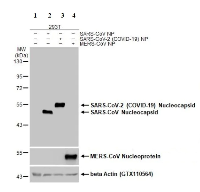 Western blot - Anti-SARS-CoV-2 nucleocapsid protein antibody [HL455-MS] - BSA and Azide free (AB281300)