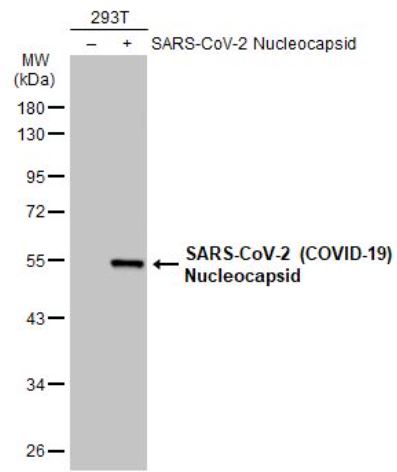 Western blot - Anti-SARS-CoV-2 nucleocapsid protein antibody [HL455-MS] - BSA and Azide free (ab281300), expandable thumbnail